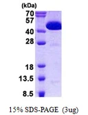 Human CIAO1 protein, His tag. GTX68051-pro