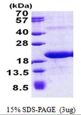 Human Surb7 protein, His tag. GTX68053-pro