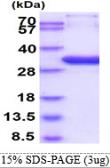 Human HAND1 protein, His tag. GTX68055-pro