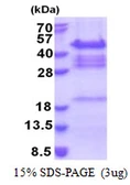 Human QKI protein, His tag. GTX68058-pro