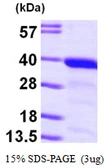 Human GGPS1 protein, His tag. GTX68060-pro