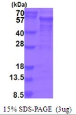 Human PICK1 protein, His tag. GTX68064-pro
