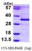 Human ATG5 protein, His tag. GTX68066-pro