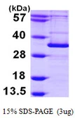 Human ATG5 protein, His tag. GTX68066-pro