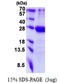 Human TRFP protein, His tag. GTX68067-pro
