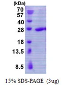 Human TLP protein, His tag. GTX68070-pro