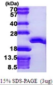 Human EEF1E1 protein, His tag. GTX68071-pro