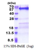 Human VPS4B protein, His tag. GTX68072-pro