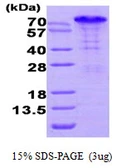 Human BAG3 protein, His tag. GTX68073-pro