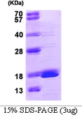 Human GMFG protein. GTX68075-pro