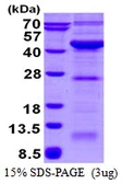 Human VPS26A protein, His tag. GTX68079-pro