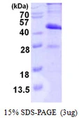 Human MAD2L1BP protein, His tag. GTX68080-pro