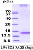 Human RNF7 protein, His tag. GTX68083-pro