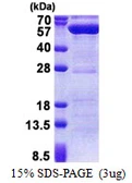 Human PPM1F protein, His tag. GTX68086-pro