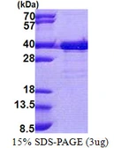 Human TTC35 protein, His tag. GTX68087-pro