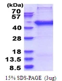 Human SERTAD2 protein, His tag. GTX68091-pro