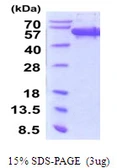 Human SCRN1 protein, His tag. GTX68092-pro