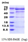 Human OXSR1 protein, His tag. GTX68096-pro