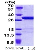 Human USP15 protein, His tag. GTX68098-pro