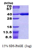 Human ACOT8 protein, His tag. GTX68100-pro