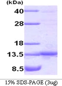 Human TANK protein. GTX68103-pro