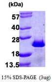 Human PDCD6 protein, His tag. GTX68104-pro