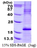 Human Bim protein, His tag. GTX68105-pro
