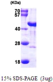 Human DNAJB6 protein, His tag. GTX68106-pro