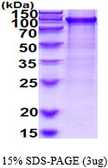 Human UBA2 protein, His tag. GTX68107-pro