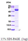 Human SAE1 protein, His tag. GTX68108-pro