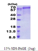 Human FARSB protein, His tag. GTX68109-pro