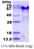 Human TSSC4 protein, His tag. GTX68111-pro