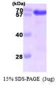 Human USH1C protein, His tag. GTX68112-pro