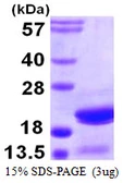 Human p16 ARC protein, His tag. GTX68114-pro