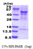 Human Arp3 protein, His tag. GTX68116-pro