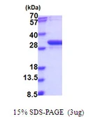 Human NUBP2 protein, His tag. GTX68117-pro