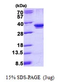 Human ARPC2 protein, His tag. GTX68118-pro