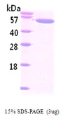 Human Visfatin protein, His tag. GTX68121-pro