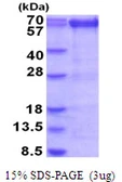 Human PRMT3 protein, His tag. GTX68125-pro