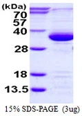 Human PSME3 protein, His tag. GTX68126-pro
