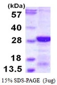 Human RCAN2 protein, His tag. GTX68129-pro