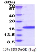 Human POP7 protein, His tag. GTX68131-pro