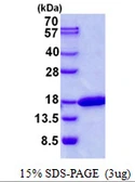 Human CDK2AP2 protein, His tag. GTX68133-pro