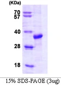Human STUB1 protein. GTX68134-pro