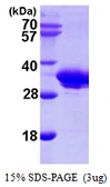Human SMNDC1 protein, His tag. GTX68135-pro