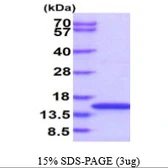 Human EIF1B protein, His tag. GTX68138-pro
