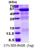 Human MAEA protein, His tag. GTX68139-pro