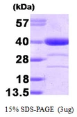 Human AKR1A1 protein. GTX68142-pro