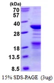 Human NPM2 protein, His tag. GTX68144-pro