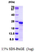 Human Myosin Light Chain 2 protein, His tag. GTX68148-pro